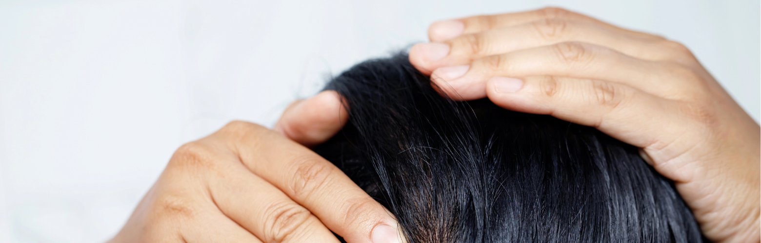 Guerre aux cheveux gras : Nos meilleures astuces pour en finir ! - Concept C. Shop