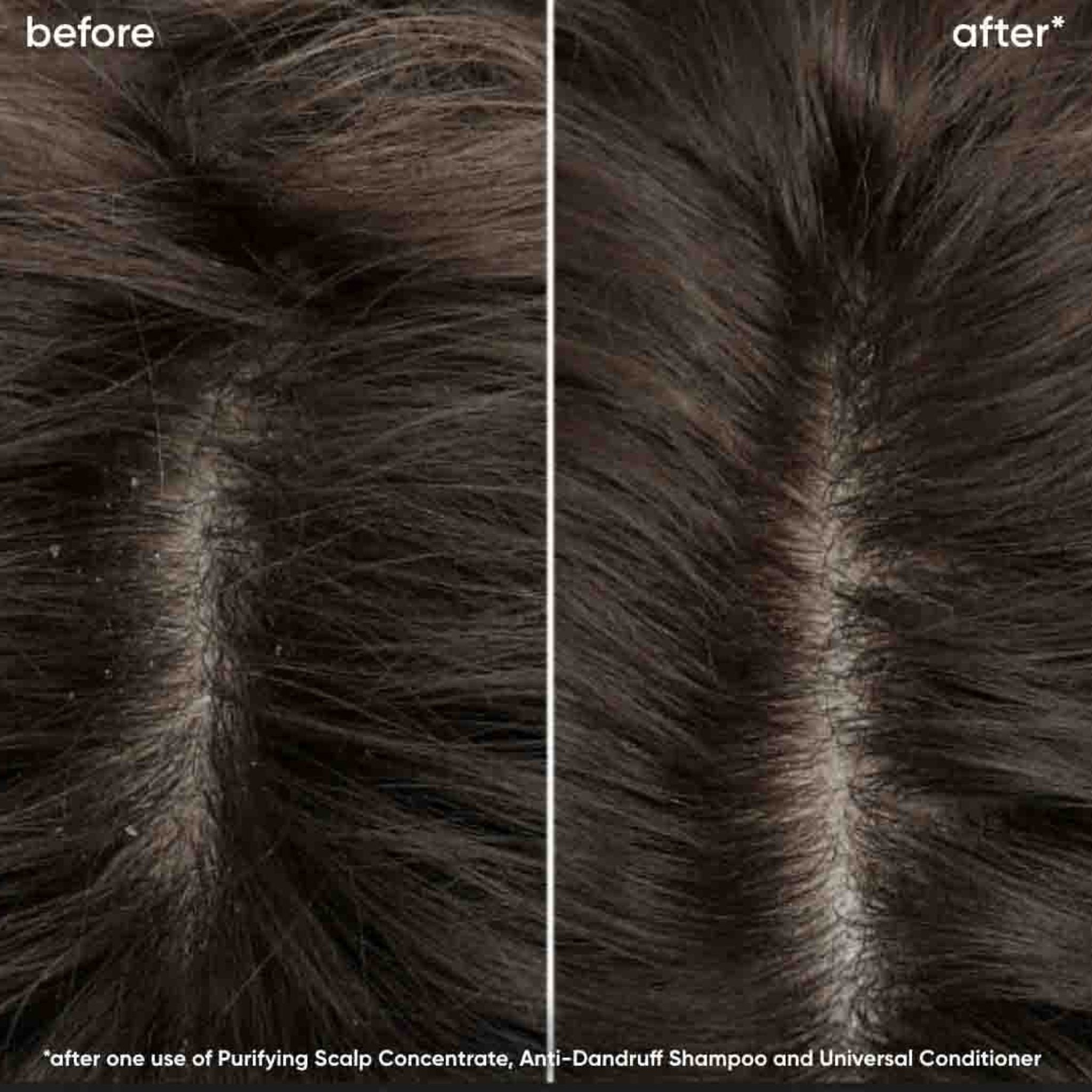 Biolage. Revitalisant Universel Scalp Sync - 1000 ml - Concept C. Shop