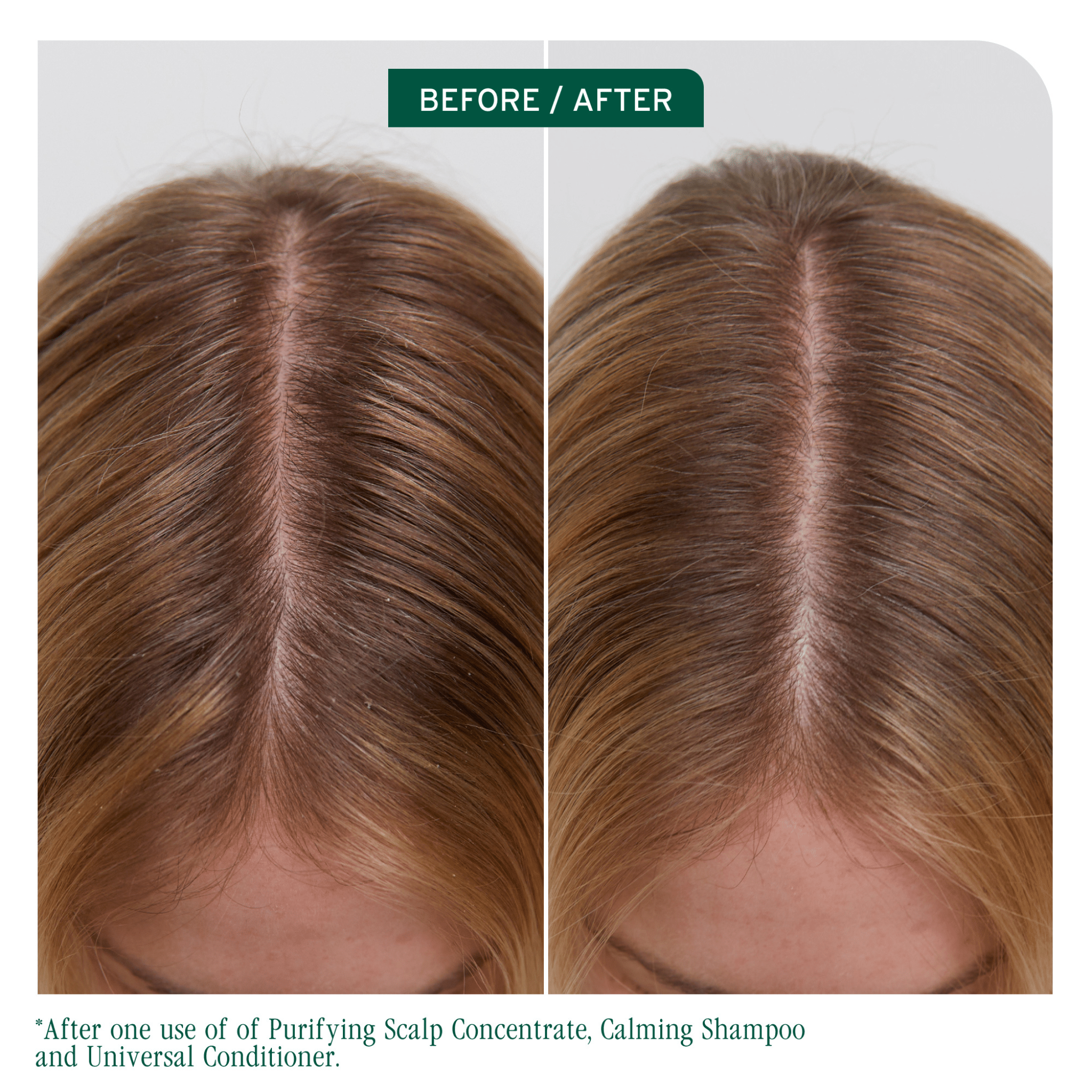 Biolage. Revitalisant Universel Scalp Sync - 236 ml - Concept C. Shop