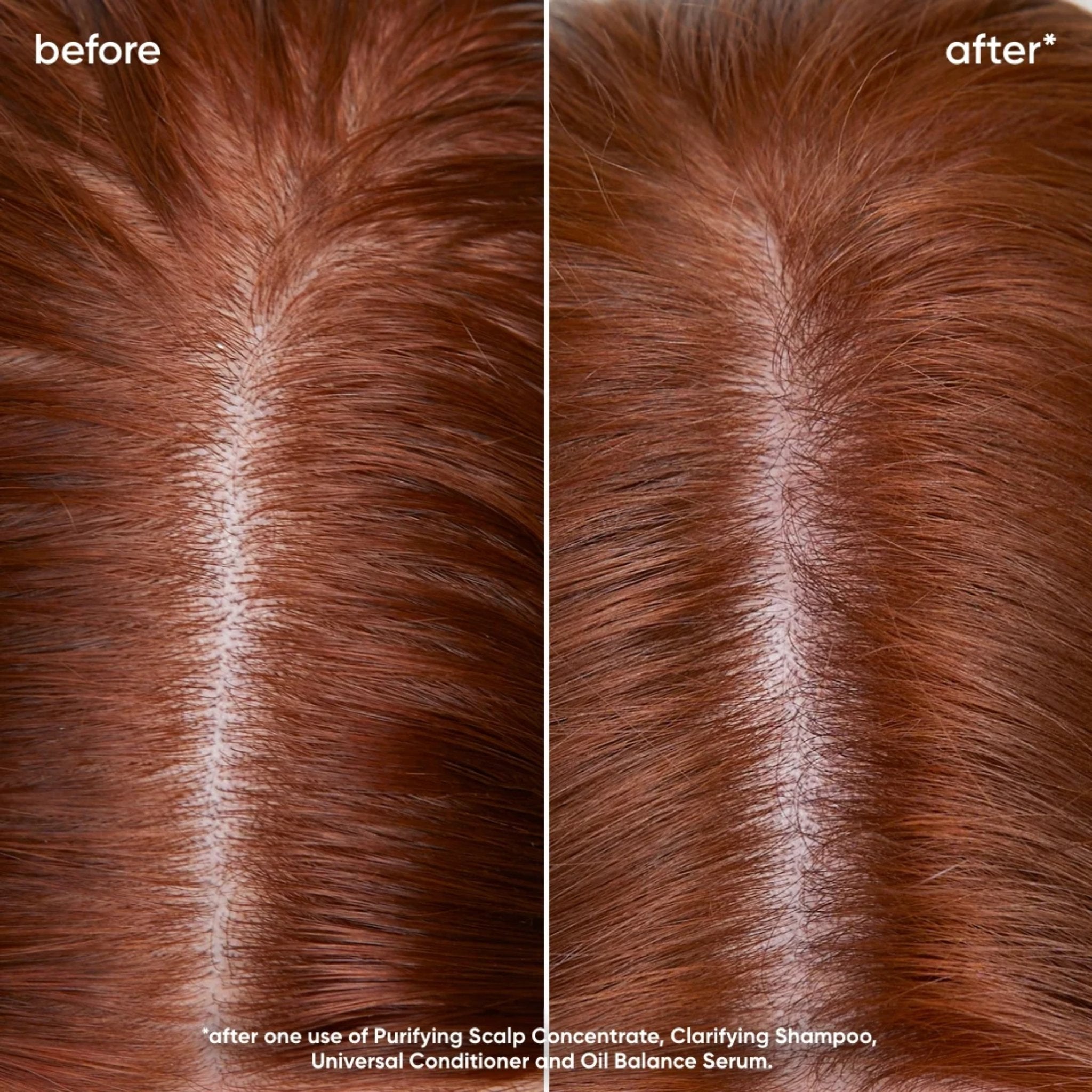 Biolage. Sérum Équilibrant le Sébum Scalp Sync - 50 ml - Concept C. Shop