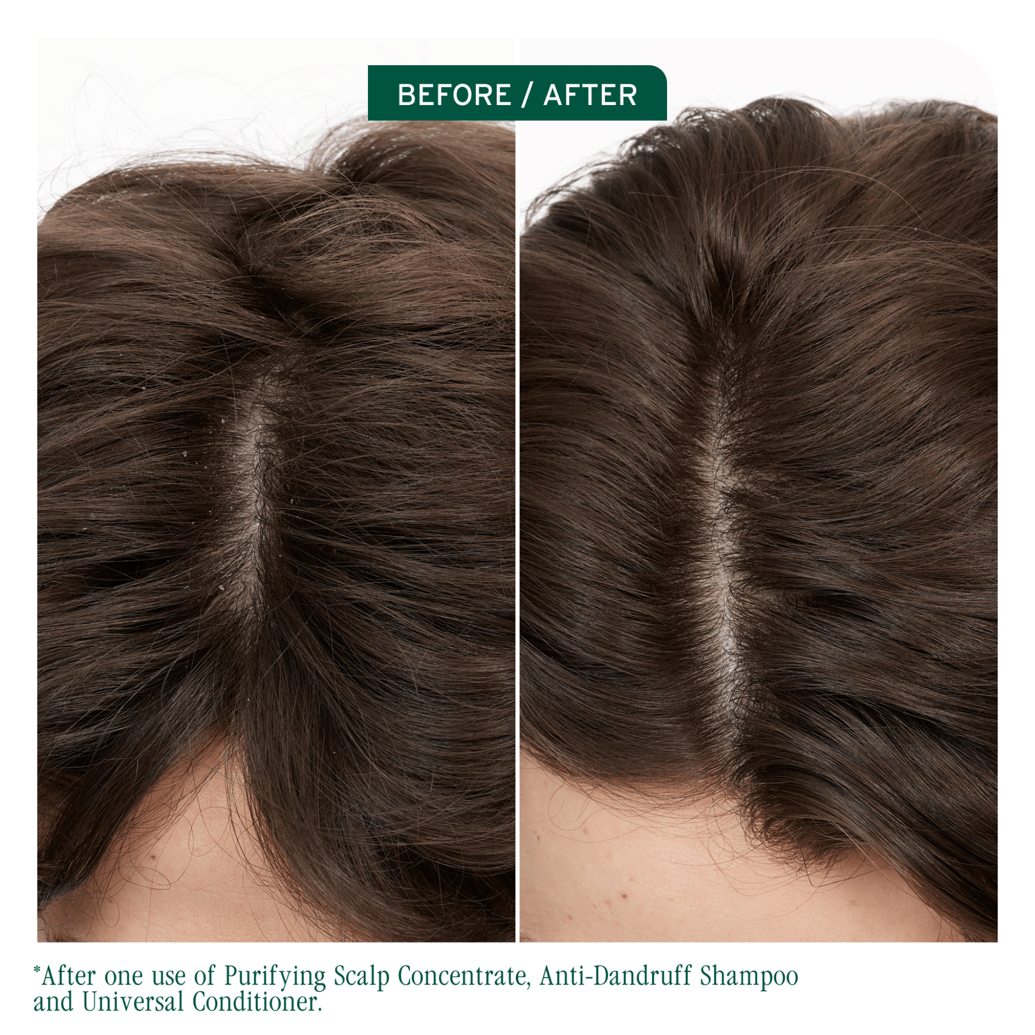 Biolage. Shampoing Anti - Pelliculaire Scalp Sync - 400 ml - Concept C. Shop