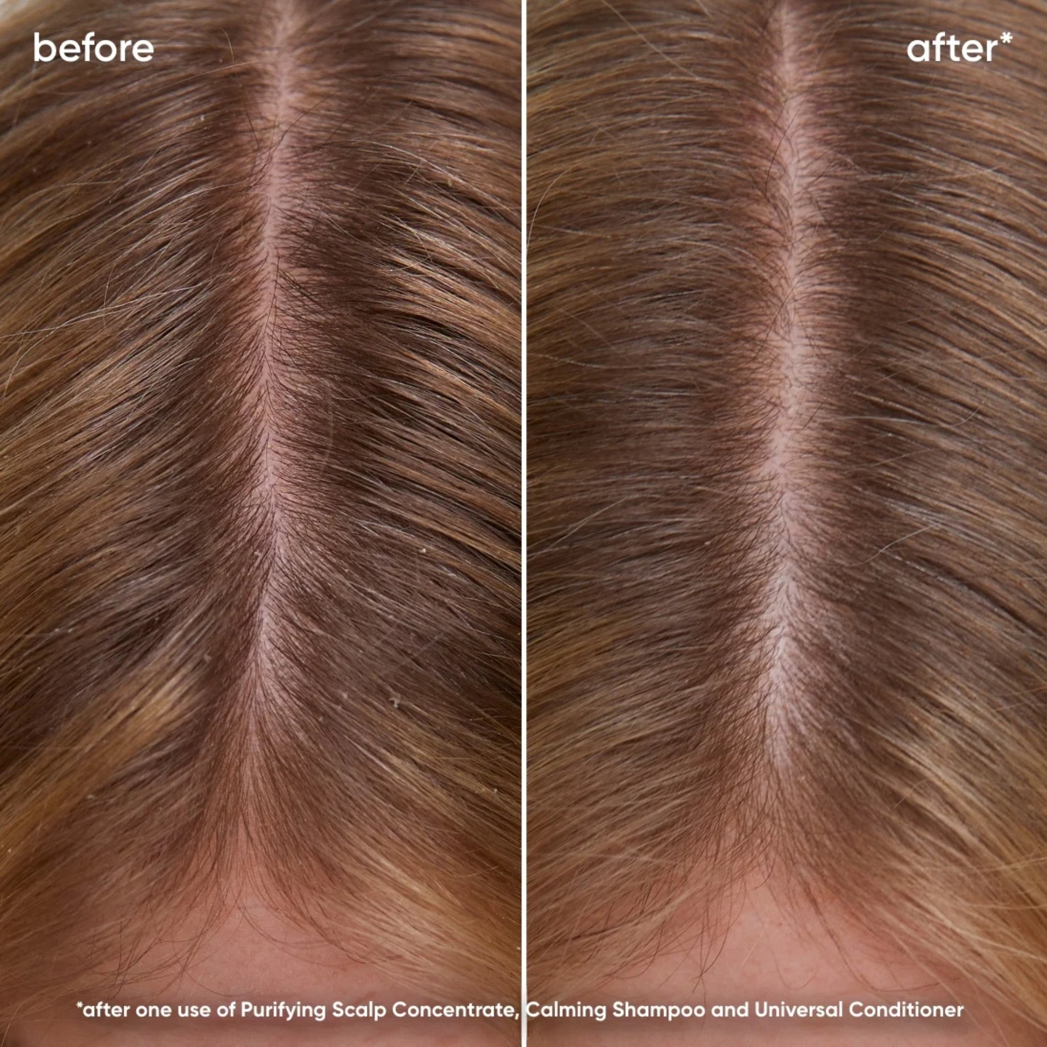 Biolage. Shampoing Calmant Scalp Sync - 1000 ml - Concept C. Shop
