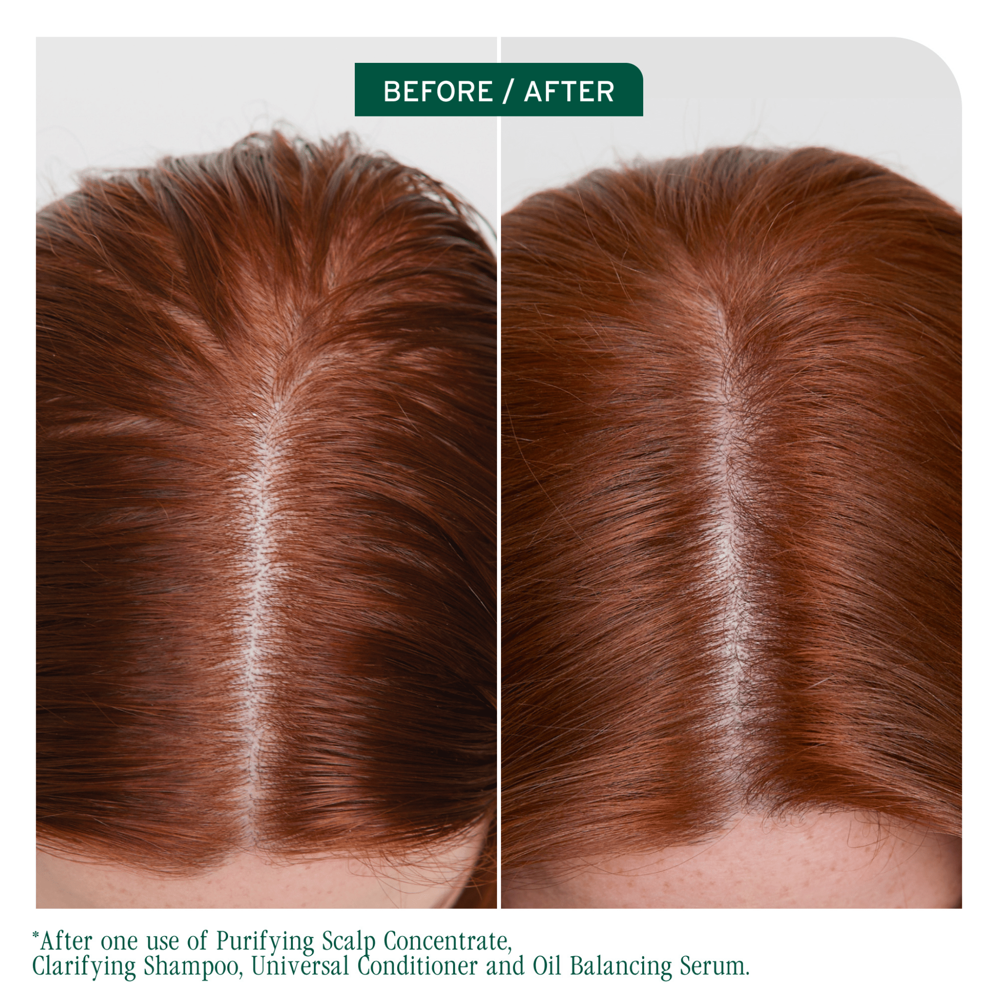 Biolage. Shampoing Clarifiant Scalp Sync - 400 ml - Concept C. Shop