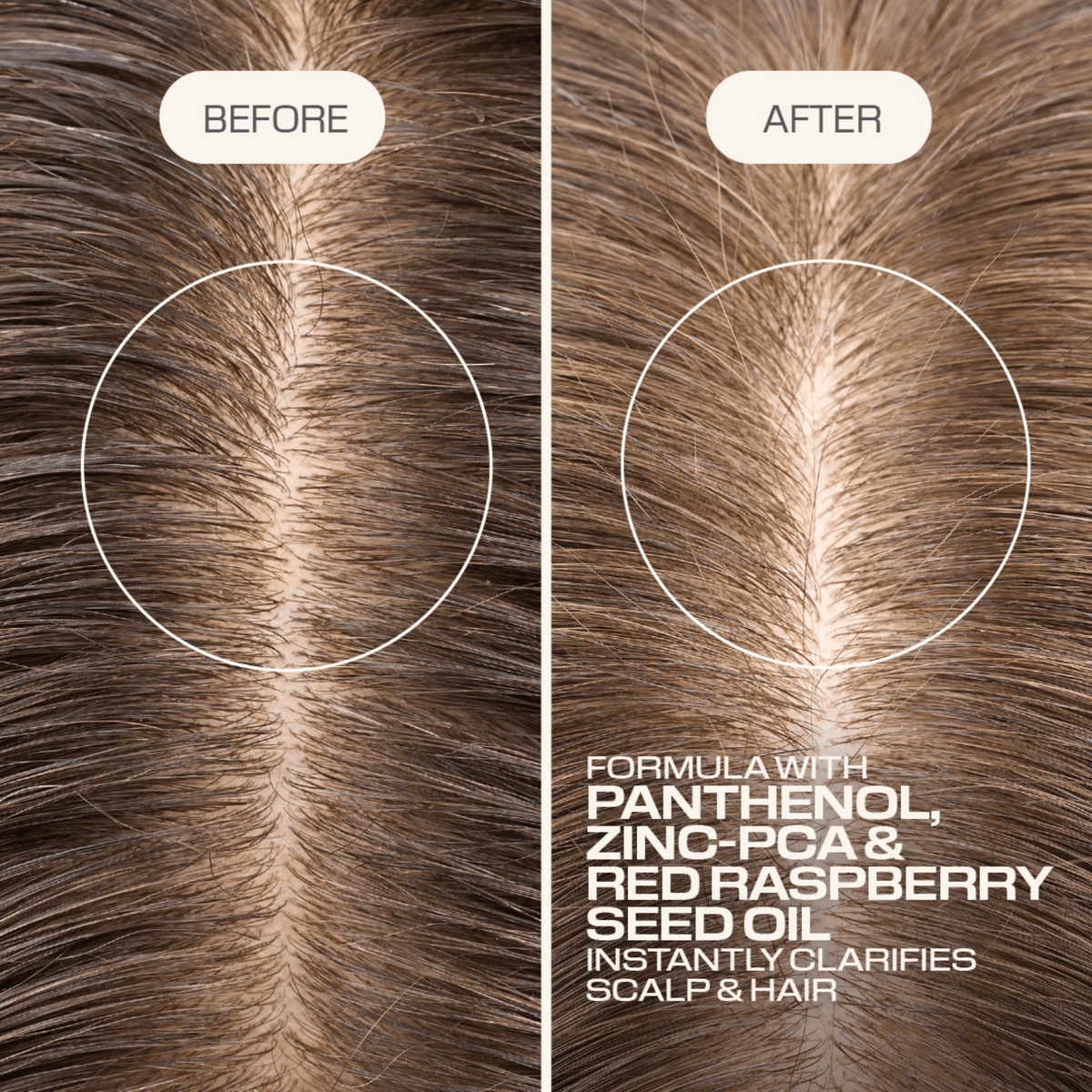 Goldwell. Shampoing Purifiant Scalp Specialist - 1000 ml - Concept C. Shop