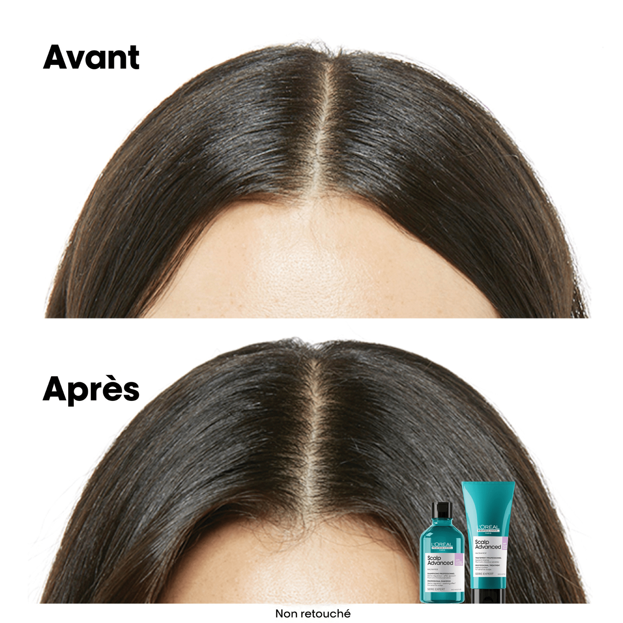 L'Oréal. Série Expert Shampoing Anti - Inconfort Scalp Advanced (Recharge) - 500 ml - Concept C. Shop