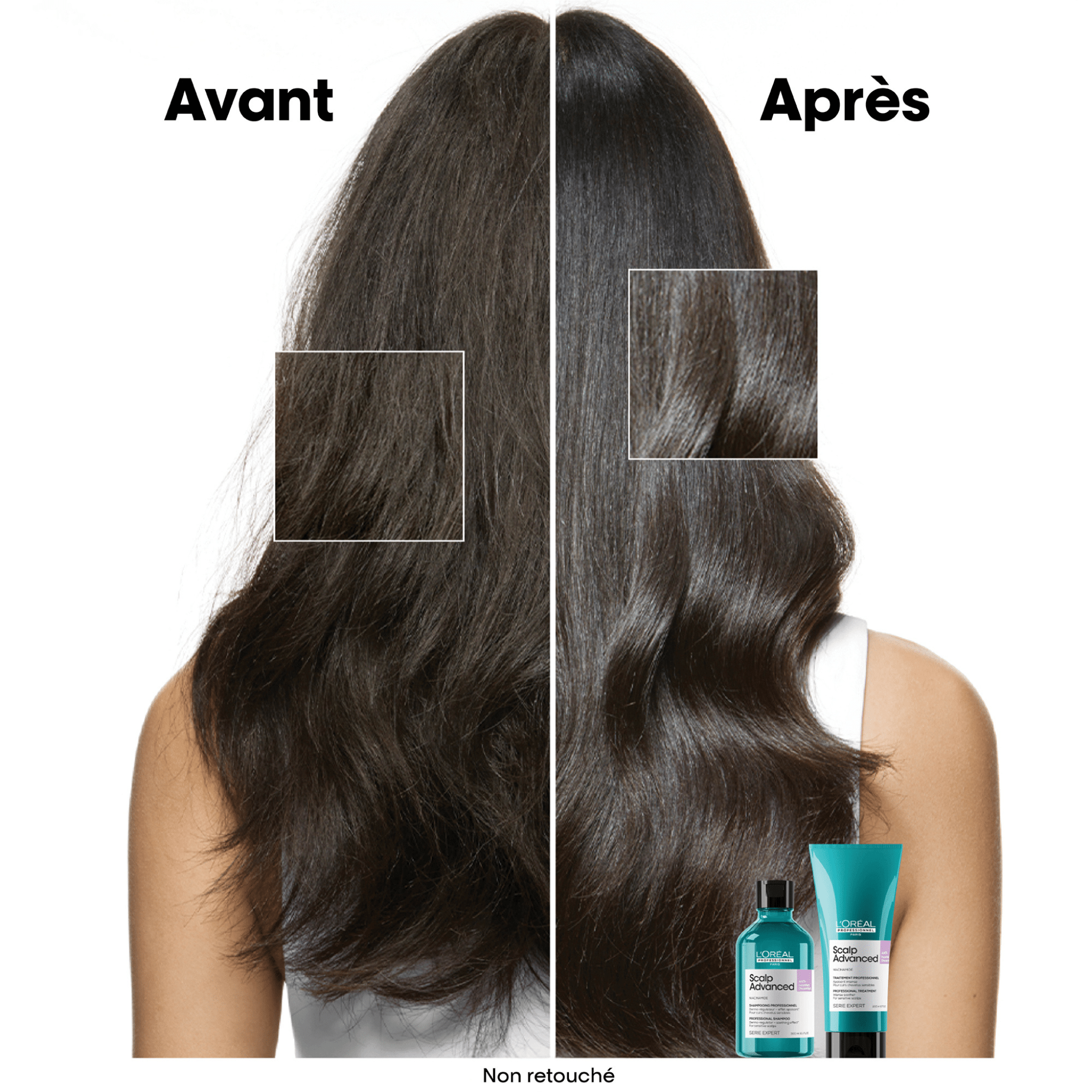 L'Oréal. Série Expert Shampoing Anti - Inconfort Scalp Advanced (Recharge) - 500 ml - Concept C. Shop