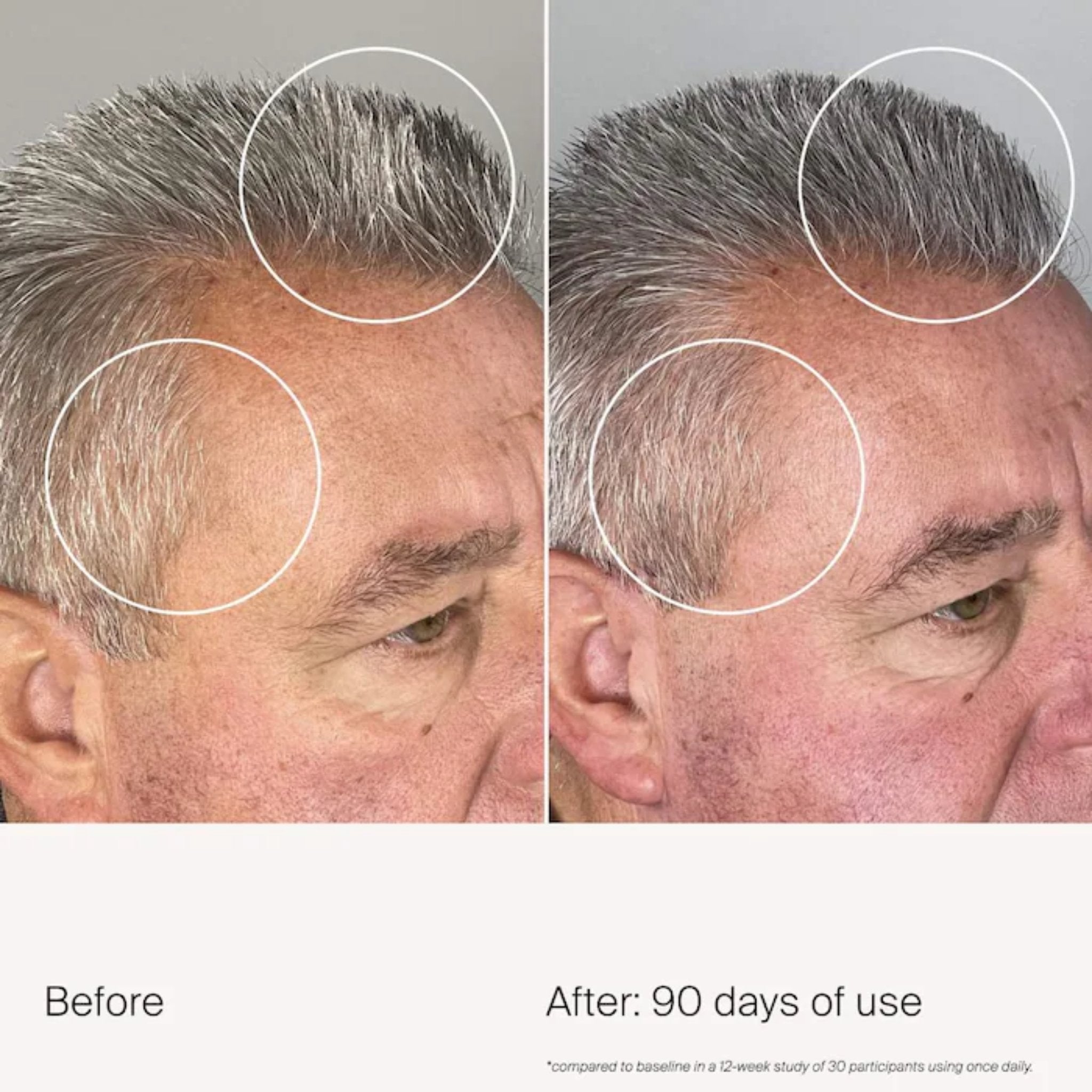 Living Proof. Sérum Densifiant Scalp Care Density - 50 ml - Concept C. Shop