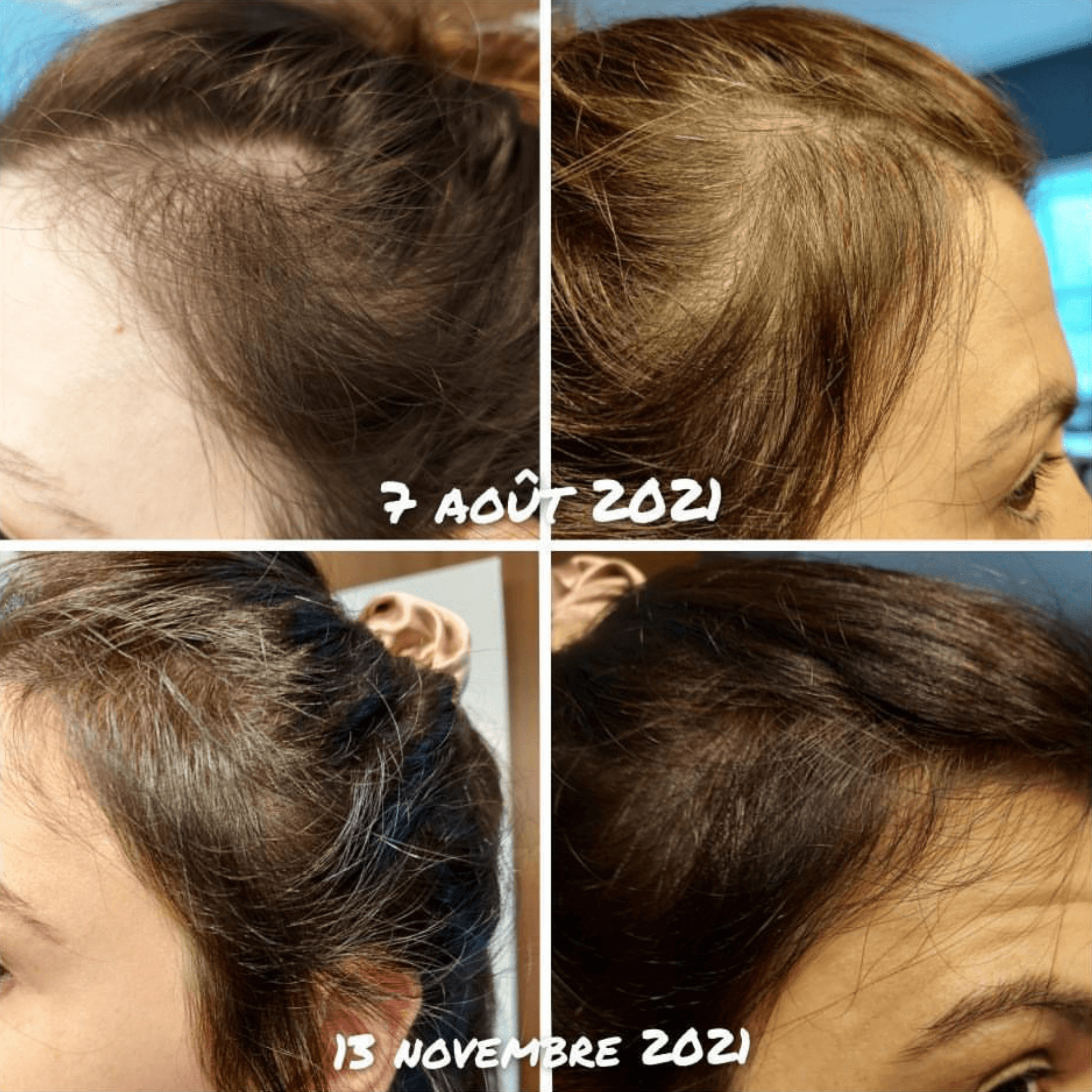 L'Oréal Série Expert. Sérum denser Serioxyl - 90 ml - Concept C. Shop