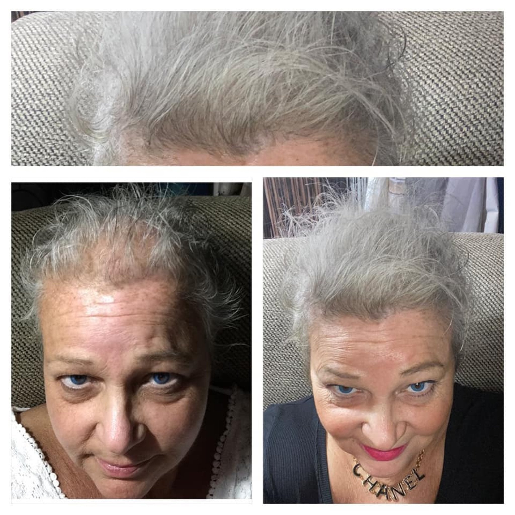 L'Oréal Série Expert. Sérum Denser Serioxyl - 90 ml - Concept C. Shop