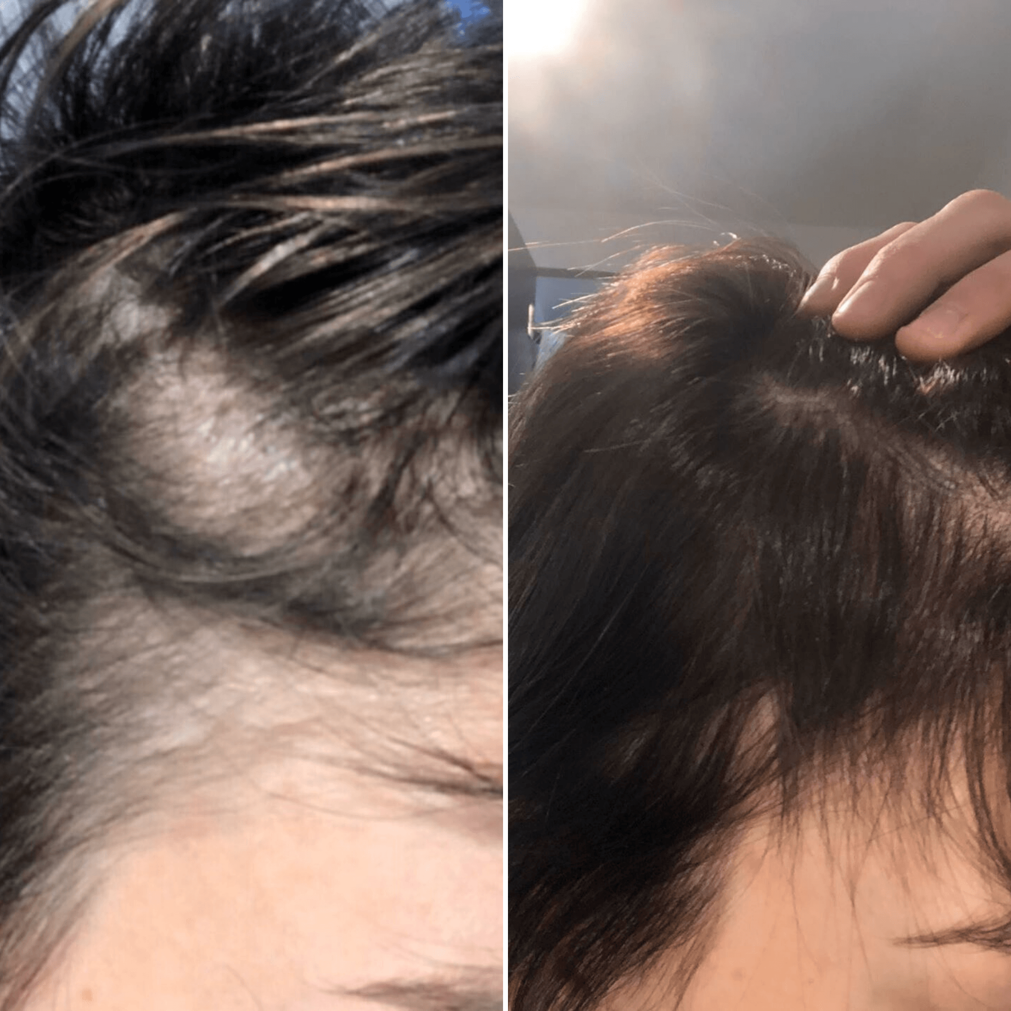 L'Oreal Serie Expert. Serum denser Serioxyl - 90 ml (délai d'expédition de 7 jours ouvrables) - Concept C. Shop