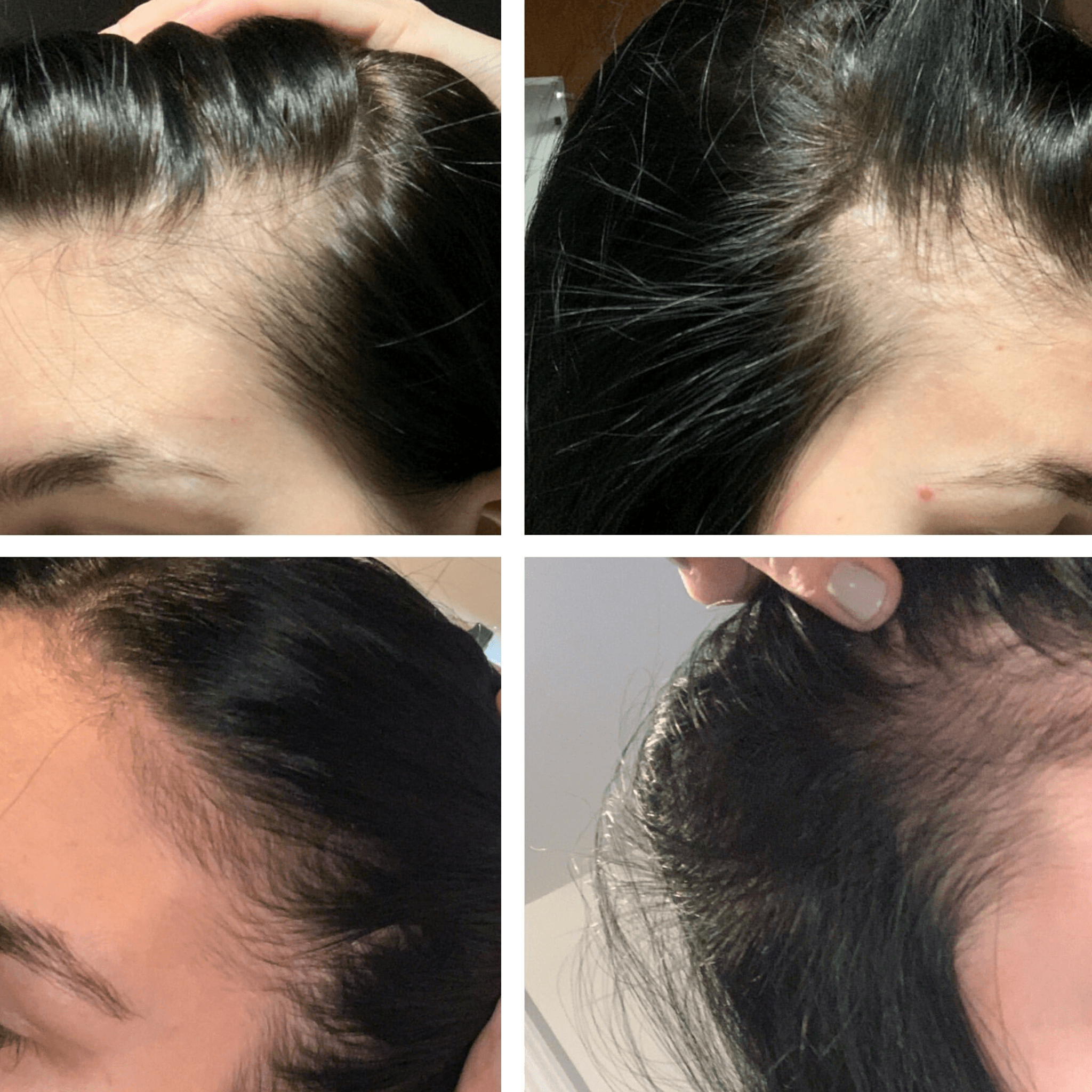 L'Oreal Serie Expert. Serum denser Serioxyl - 90 ml (délai d'expédition de 7 jours ouvrables) - Concept C. Shop