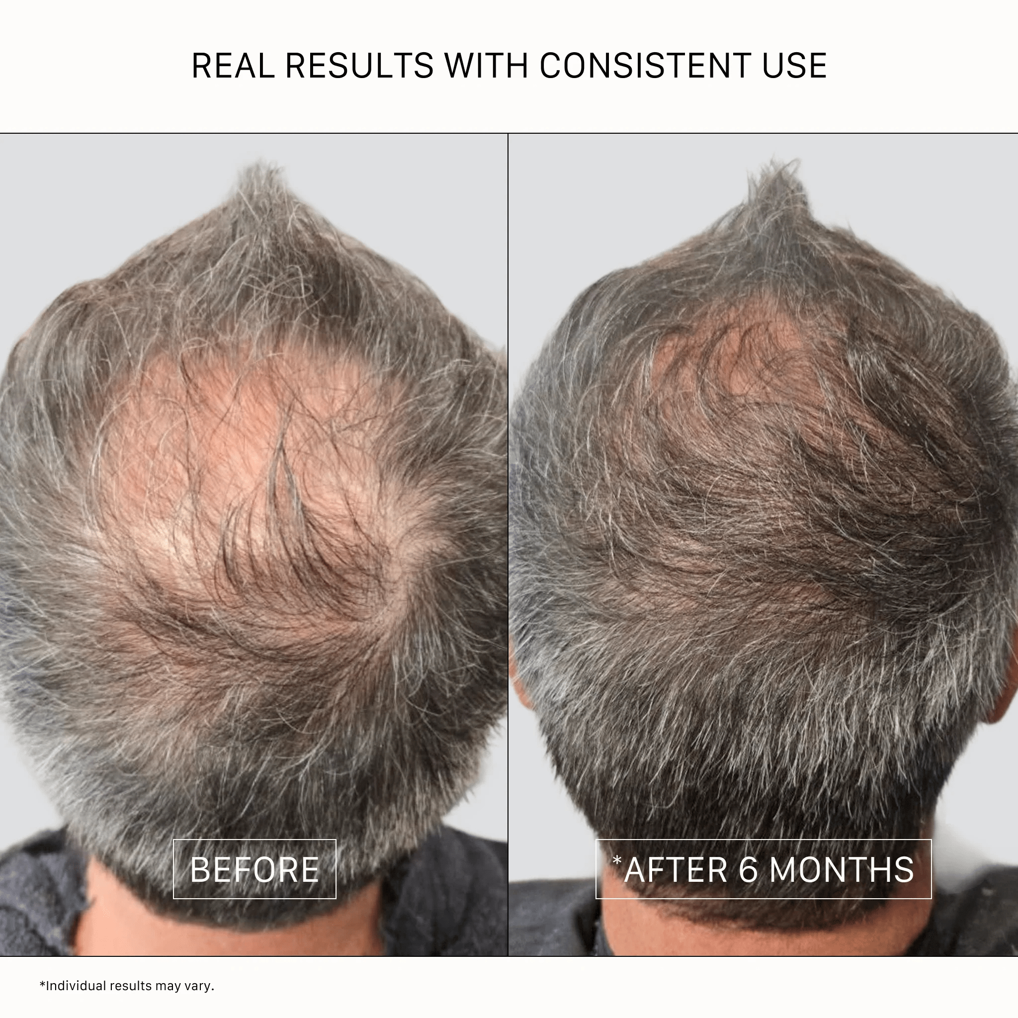 Actiiv. Revitalisant Recover - 215 ml - Concept C. Shop