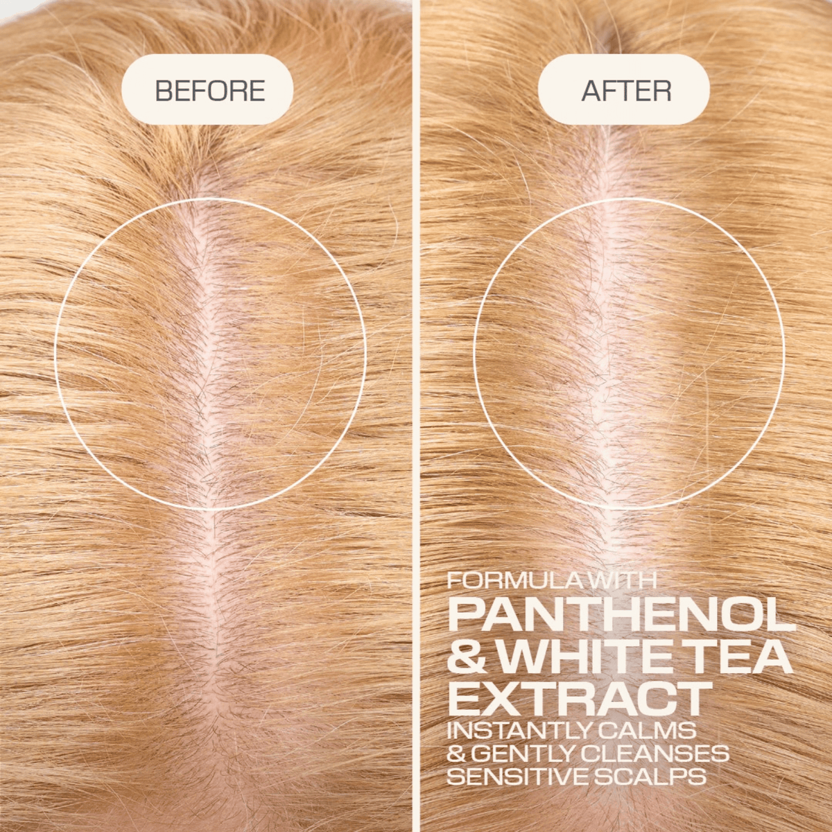 Goldwell. Shampoing Mousse Sensitif Cuir Chevelu Sensible Scalp Specialist - 250 ml - Concept C. Shop