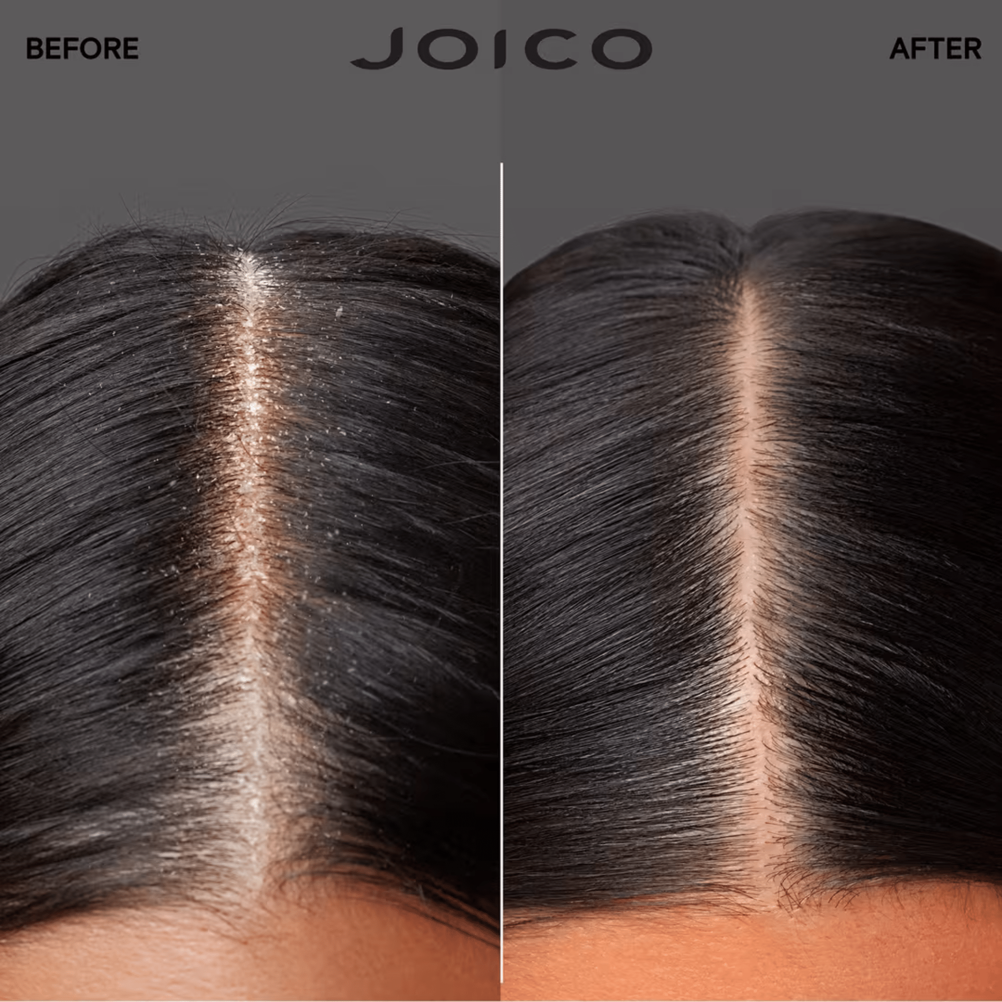 Joico. Essence Nourrissante Scalp Vitality - 100 ml - Concept C. Shop